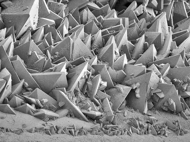 Kidney stone under electronic microscope. You can tell why it hurts so much | MirrorLog